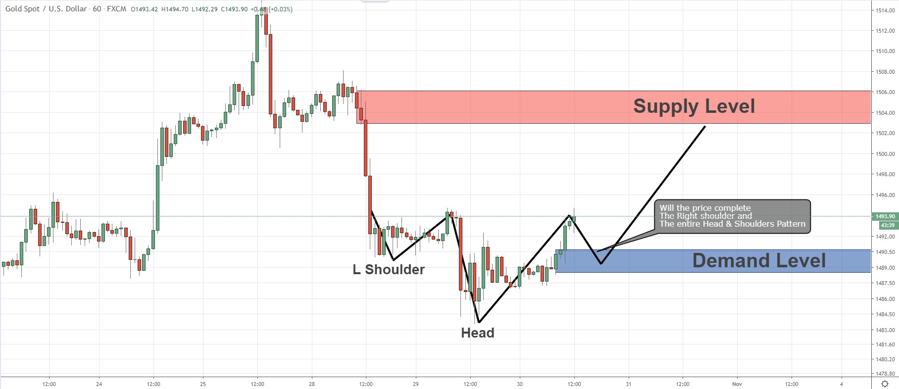 الگوی سر و شانه معکوس (Inverse head and shoulders)